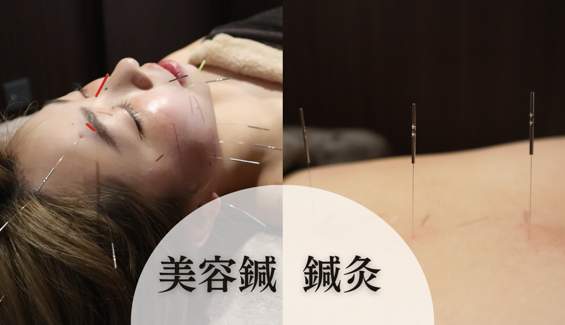 来院されるお客様のきっかけについて